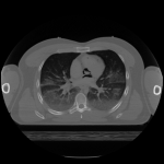 Visible Male CT Datasets
