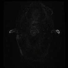 7T-Neuro-Images-Axial-FSPGR-BRAVO-T1-TE-_-3.0-TR-_-7.5