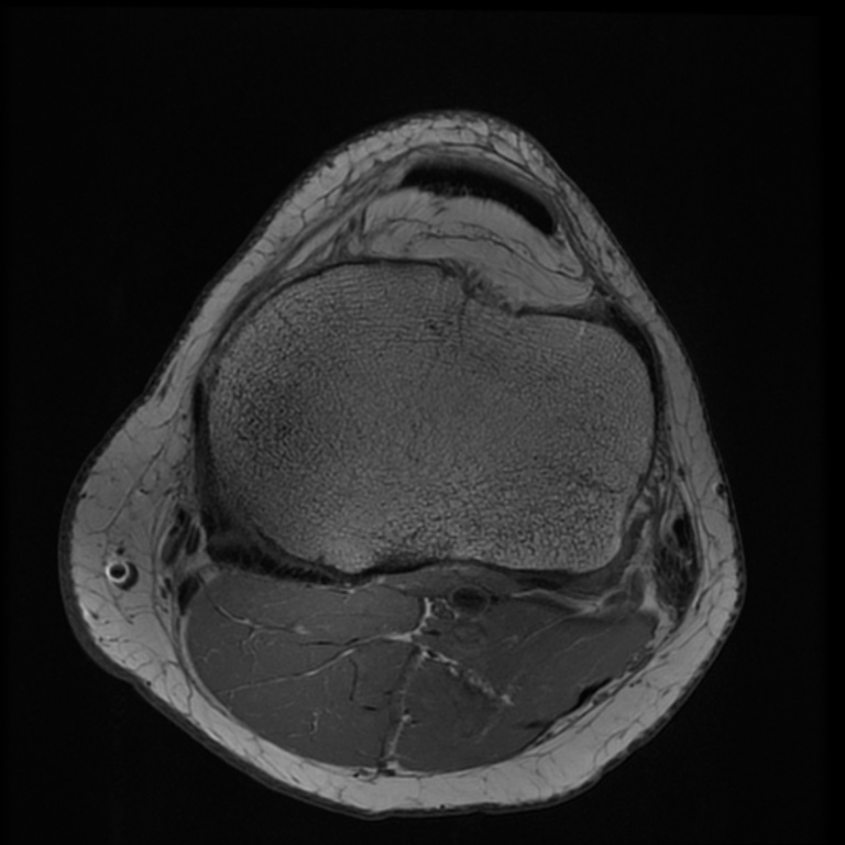 7TOrtho Images - SC-Axial T1 ARC Human Knee TE = 11.2 TR = 1125.0-2