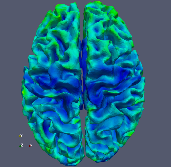 Figure (C): Cortical depth measurement axial, blue to red rainbow coloration, axial view. This is a visualization of an auto-calculated statistic.