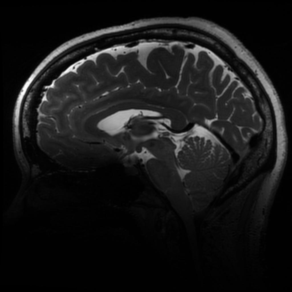 7T Neuro Images - Sagittal T2 CUBE TE = 77.7 TR = 2500.0