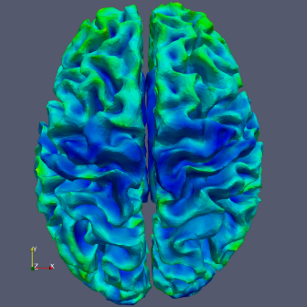 Figure (C): Cortical depth measurement axial, blue to red rainbow coloration, axial view. This is a visualization of an auto-calculated statistic.